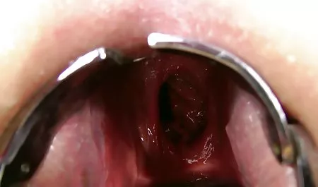 تریاک فیلم سکسی کامل رایگان برای هیچ کس (کاکوت Korbalin) ، نمایش پرده ای